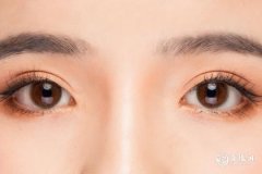 女人面部最忌讳的痣 可以点掉吗