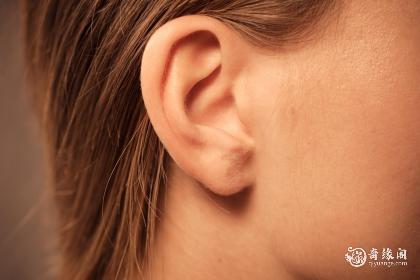 女人耳朵上有痣代表什么意思